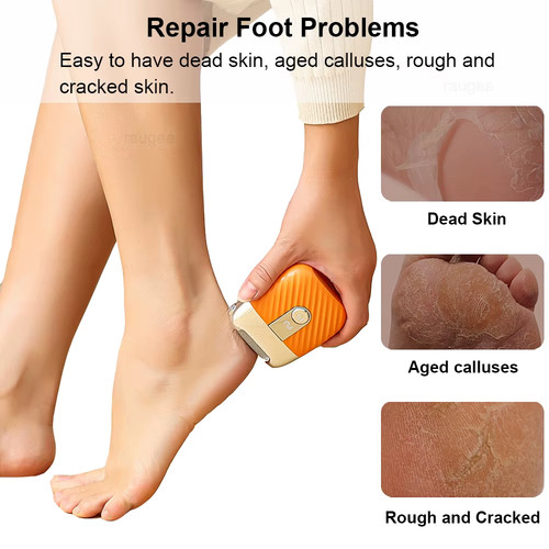Electric foot file - foot,