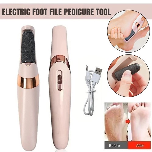 Feet callus remover - remover, electric